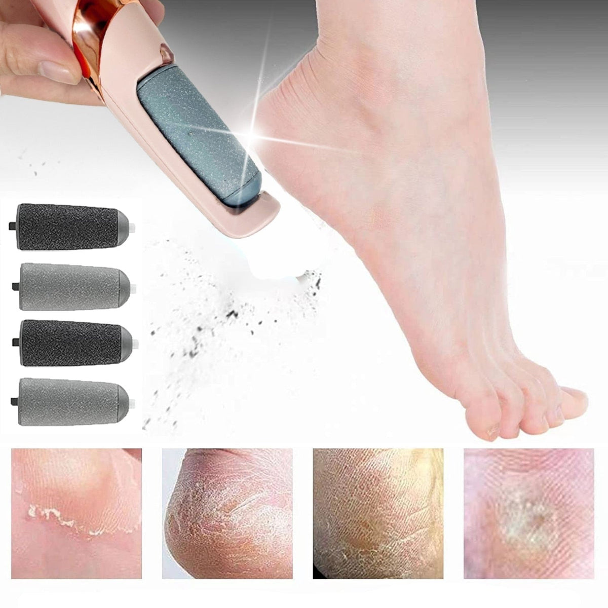 Soft Feet - Callus and Cracked Heel Remover
