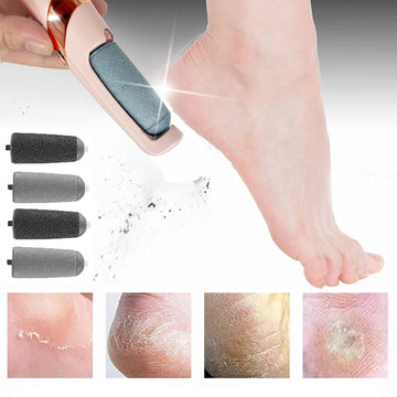 Soft Feet - Callus and Cracked Heel Remover